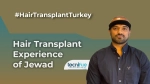 Hair Transplant Experience of Jewad with TecniFUE International