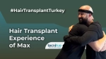 Hair Transplant Experience of Max
